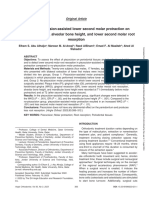 Effect of Piezocision-Assisted Lower Second Molar Protraction On Periodontal Tissues, Alveolar Bone Height, and Lower Second Molar Root Resorption