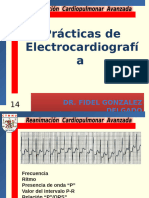 14 Trazos Electrocardiograficos