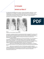 Radiologia Do Coração