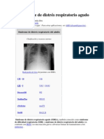 El Síndrome de Distrés Respiratorio Agudo