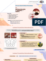 Traumatismos Dentoalveolares en Dentición Temporal y Permanente (Grupo #4)