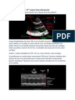 I. para Sternal:: (2 Espace Intercostal Gauche)