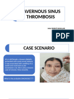 CAVERNOUS Sinus Thrombosis