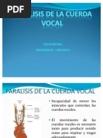 Paralisis de La Cuerda Vocal