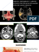 Seminario RD 2 Anatomía Radiológica Del Cuello