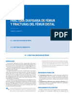 Fracturas Diafisiarias de Fémur y Fracturas Del Fémur Distal