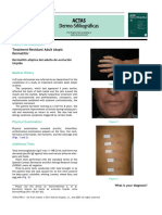 Treatment-Resistant Adult Atopic Dermatitis