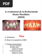 Le Traitement de La DDM