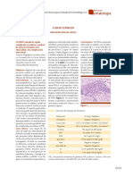 HematoSUPL1 2018casos Clinicos