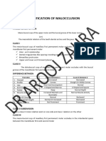 Classification of Malocclusion