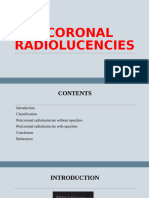 Sem 8 - Pericoronal Radiolucencies