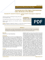 Two Cases of Primary Leiomyosarcoma of The Vagina Histomorphologic Presentation With Review of The Literature