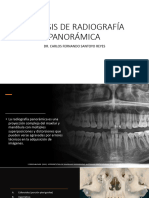 Análisis de Radiografía Panorámica: Dr. Carlos Fernando Santoyo Reyes