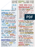 Ekg Review Cheat Sheet