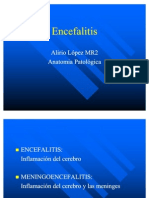 ENCEFALITIS