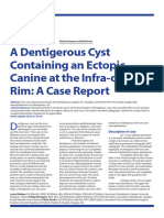 A dentigerous cyst containing an ectopic canine at the infra-orbital rim a case report