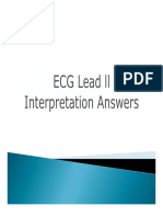 ECG_Lead_ll_Interpretation_Answers