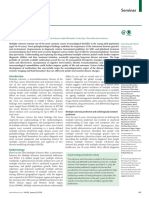 Esclerosis Multiple