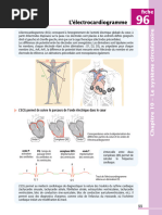 L’électrocardiogramme