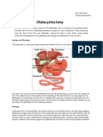 Cholecystectomy