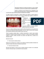 Guarda Oclusal Rul