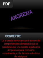 Anorexia