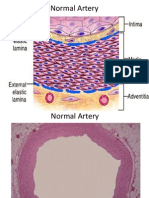 Atherosclerosis 1