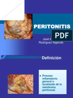 Peritonitis