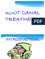 Root Canal Treatment