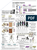 Infografia Osteoporosis