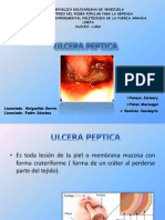 Ulcer A