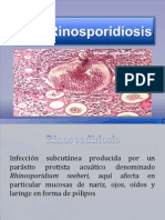 Rinosporidiosis