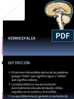 HIDROCEFALIA