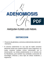 ADENOMIOSIS Presentacion