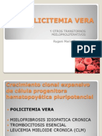 Policitemia Vera