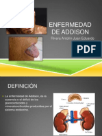 Enfermedad de Addison