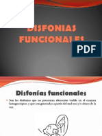 Disfonia Funcional