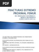 Fracturas Extremo Proximal Femur