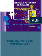 Periodontitis Prepuberal