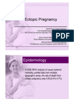 Ectopic Pregnancy