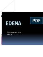 Edema