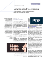 Lingualized Occlusion Review