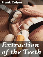 Extraction of the Teeth