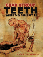 TEETH WHERE THEY SHOULDN'T BE