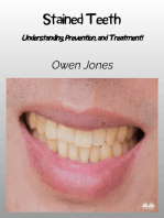 Stained Teeth: Understanding, Prevention, And Treatment!