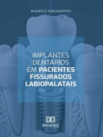 Implantes dentários em pacientes fissurados labiopalatais