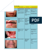 Disorders of The Lips, Mouth and Gums