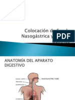 Sonda Nasograstrica