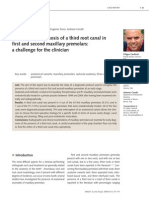 Preoperative Diagnosis of A Third Root Canal in First and Second Maxillary Premolars A Challenge For The Clinician