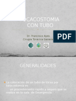 Toracostomía Con Tubo de Tórax